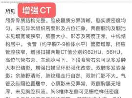 食管癌晚期患者，化疗+免疫进行中，求问还有其他方案吗？哪个医院更推荐么？