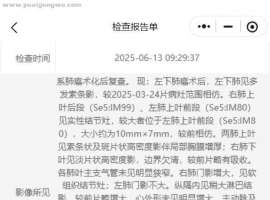 肺腺癌术后一年复查，这是复发转移了吗？