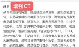 食管癌晚期患者，化疗+免疫进行中，求问还有其他方案吗？哪个医院更推荐么？