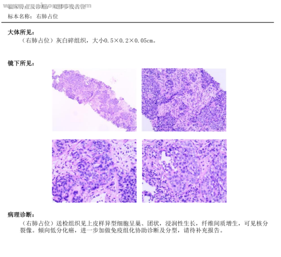 病理常规